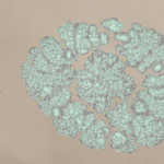 CMDR Hanna Hunter, Bacterium cerbrus, Slegeae UB-J d10-1, 2